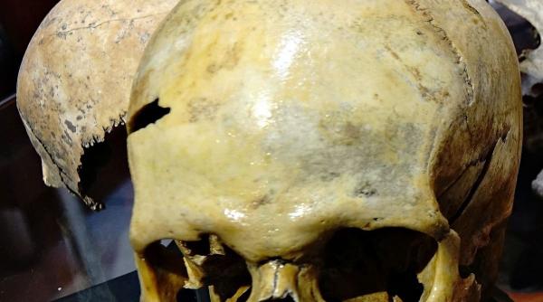 Ce au aflat polițiștii despre craniul uman găsit la Vaslui. A fost deschis un dosar penal